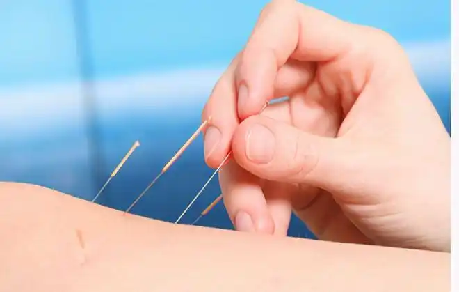 针灸治疗肠炎 针灸治疗肠炎